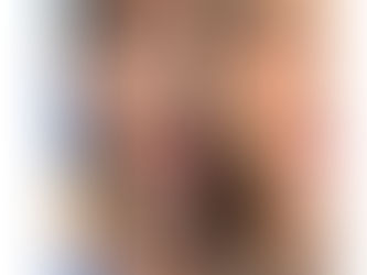 Mini Lifting Facial: La Técnica Imbatible en Rejuvenecimiento