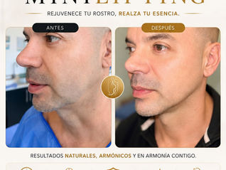 Mini lifting facial masculino quirúrgico en Medellín, El Poblado | Dra. Amy Barreto