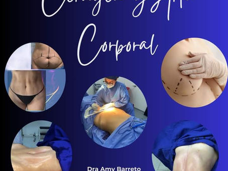 Abdominoplastia / Tummy Tuck  con corrección de hernia en Medellín: la experiencia de la Dra. Amy Barreto