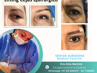 Lifting Quirúrgico de Cejas en Bogotá Zona Norte