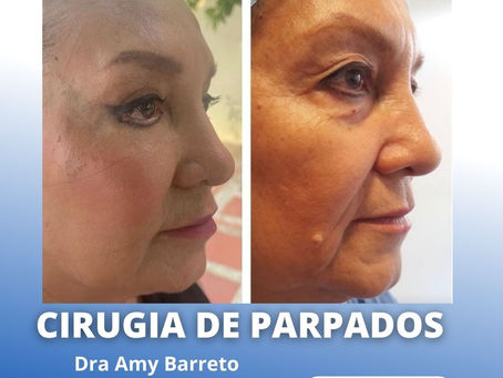 BLEFAROPLASTIA PRECIOS 2023 COLOMBIA