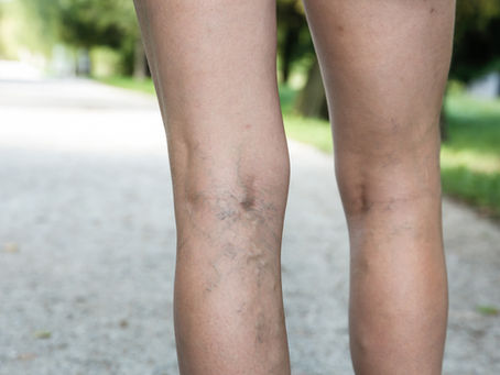 What are your veins telling you?