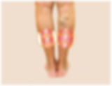 Vein Treatments Plano TX