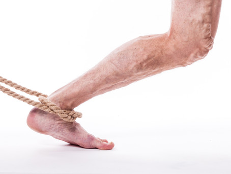 What are Varicose Veins?