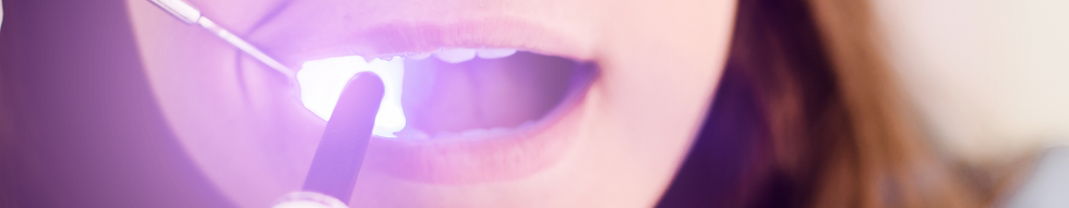 Sealen bij Tandheelkunde Damwoude