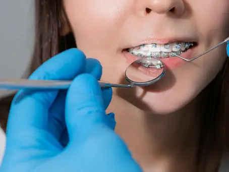 How to Choose the Right Orthodontist in Livonia for Your Smile