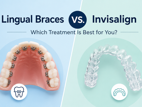 Lingual Braces vs. Invisalign: Which Treatment Is Best for You?