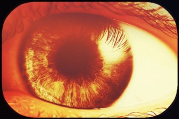 Transparency-Reveals-Content-Opportunity-Cover