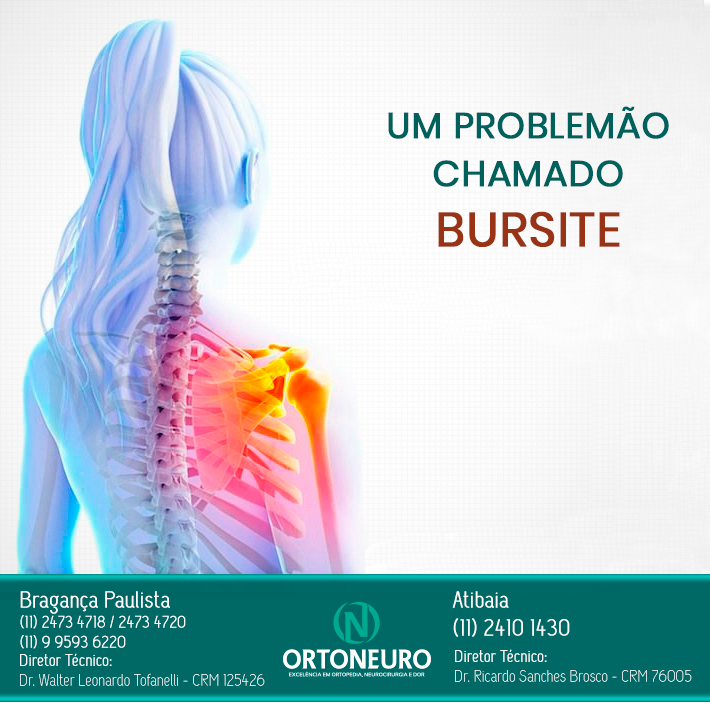 Bursite no ombro sintomas