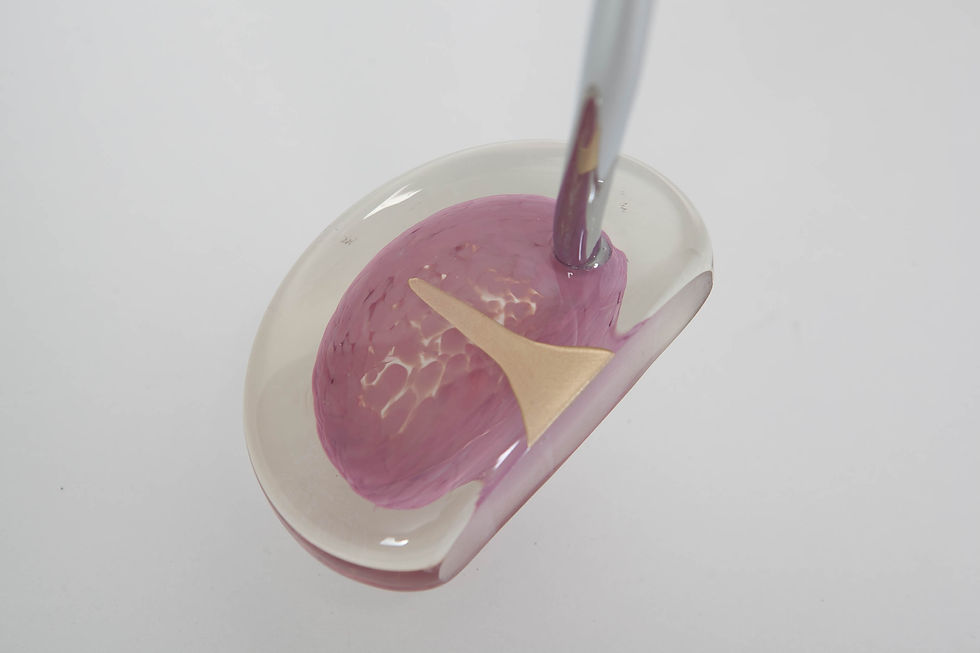 Thumbnail: Assorted Solid Color Mallets 