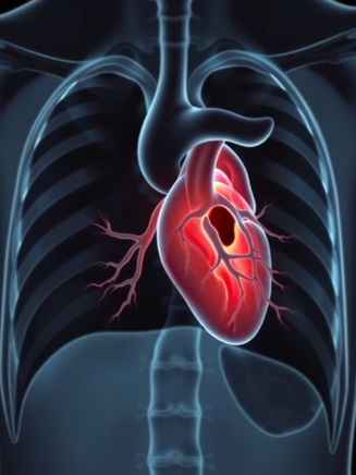 Aortic Dissection: pathophysiology and the vital role of medical professionals