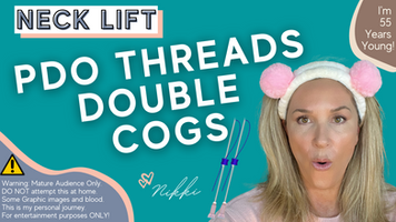 Neck Lift with PDO Cog Threads