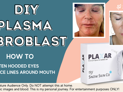 PLASMA FIBROBLAST: (See Results) Tighten Skin & Reduce Wrinkles! PLAXAR PLASMA PEN