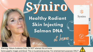 Syniro PDRN Injections - Does it Work? 