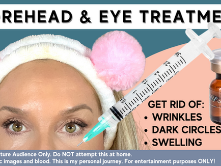 Want to Know the Solution for Fine Lines and Dark Circles?