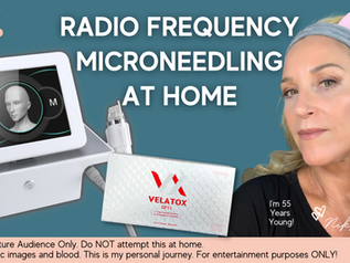 How I Used Radiofrequency Microneedling at Home to Improve My Skin!