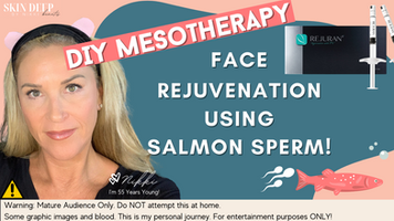 Mesotherapy for Face DIY 