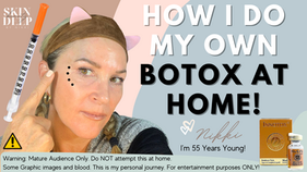 Botox At Home ~ How I Do It Myself!