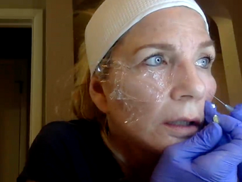 THREADS: Eye Cannula 101 1:1 Carol/Nikki