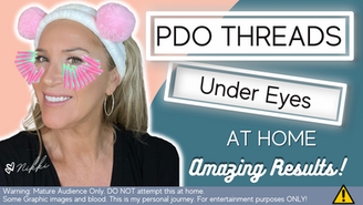 PDO Threads For Under Eye Wrinkles
