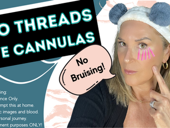 THREADS: PDO Threads for Under Eyes