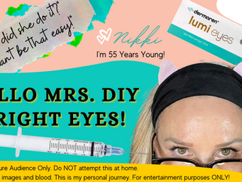 Under Eye Treatment At Home!