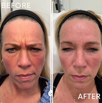 Before after minimal skincare Instagram post.zip - 2.PNG
