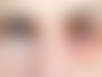 Allergy Symptoms on Eyes | Panoptic Vision