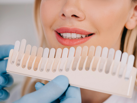 Common Causes of Teeth Discolouration and How Teeth Whitening Can Help
