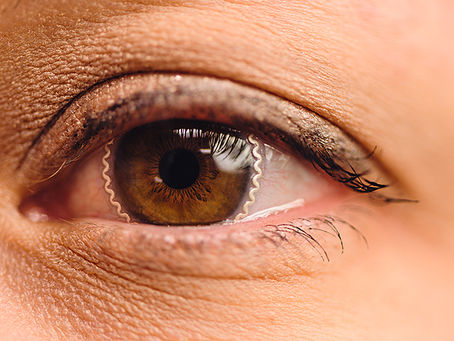 High-tech startup creates smart contact lenses for glaucoma diagnosis