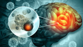 Groundbreaking study points to an effective cure for brain cancer