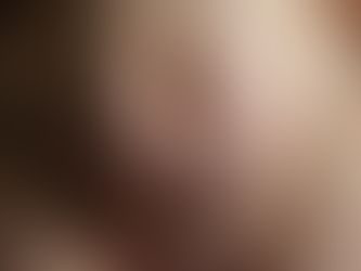 Quando é a Hora Certa de Fazer a Cirurgia para Hérnia Umbilical?