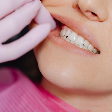 A dentist checking a clients mouth