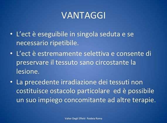 vantaggi