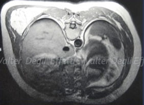 immagine radiologica