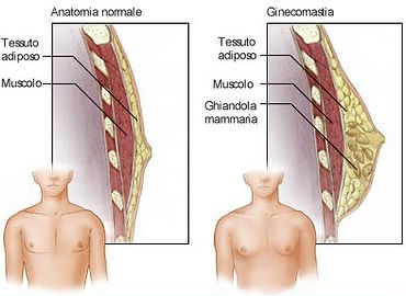 la mammella dell'uomo normale patologica