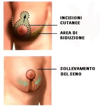 tecnica chirurgica