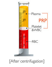 PRP LA CAPACITA' DI RINNOVARCI E' DENTRO DI NOI