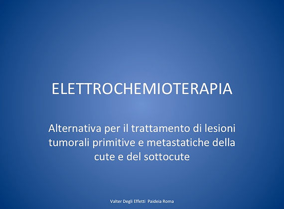 cosa è