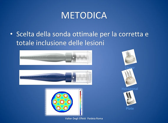 la scelta della metodica ed apperecchiatura adatta