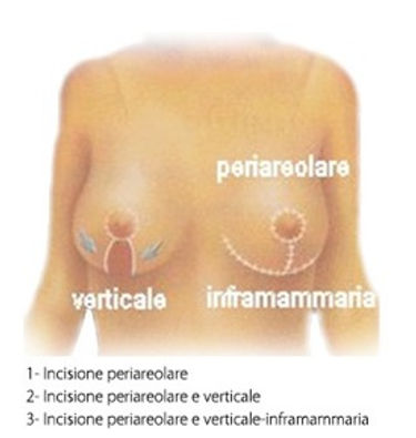 incisioni e cicatrici