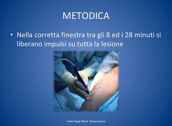 come si applica