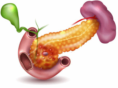 AnimatedPancreatitis.gif