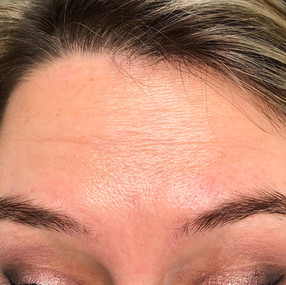 Female 39 years