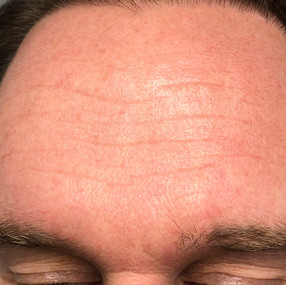 Male 43 years