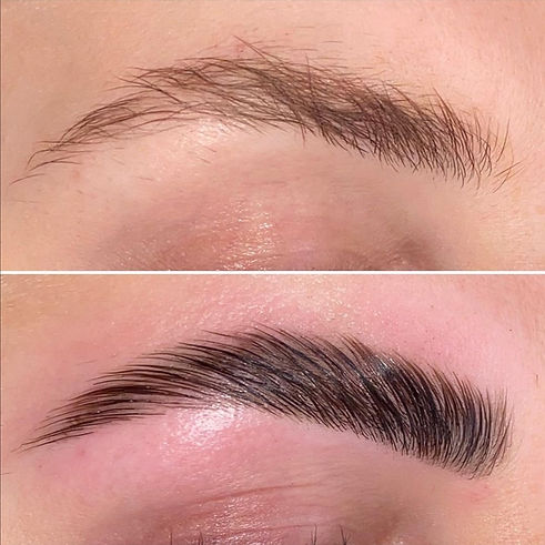 Browlifting.jpg