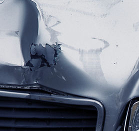 Paintless Dent Repair1
