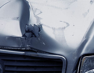 Paintless Dent Repair1