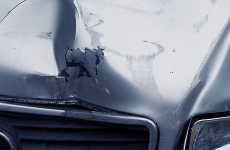 Paintless Dent Repair1