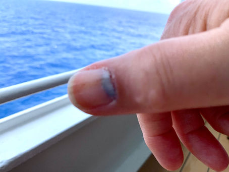 Drink stick splint - May 1, 2023